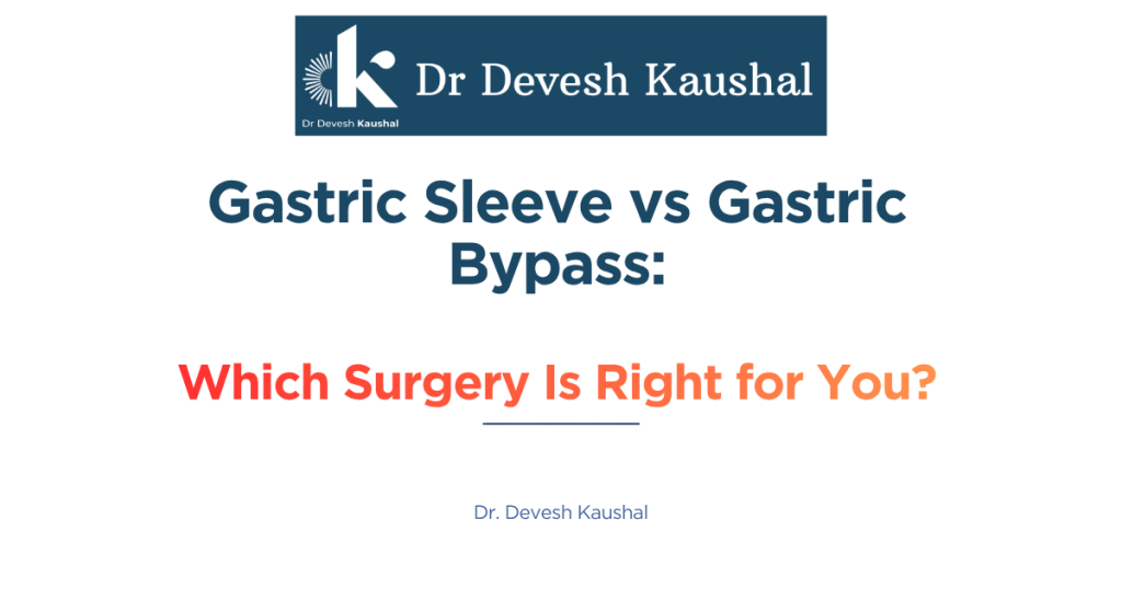 Gastric Sleeve vs Gastric Bypass